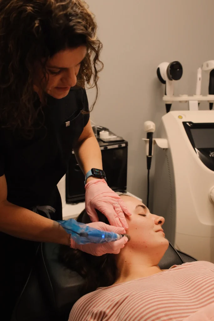 Microneedling
