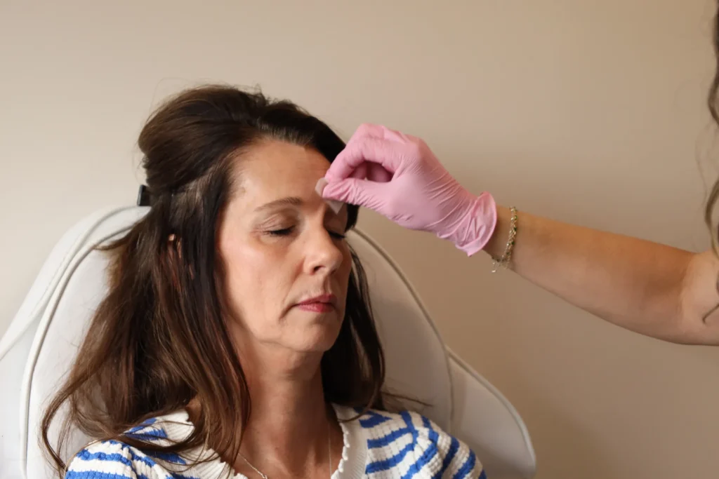 Dysport treatments