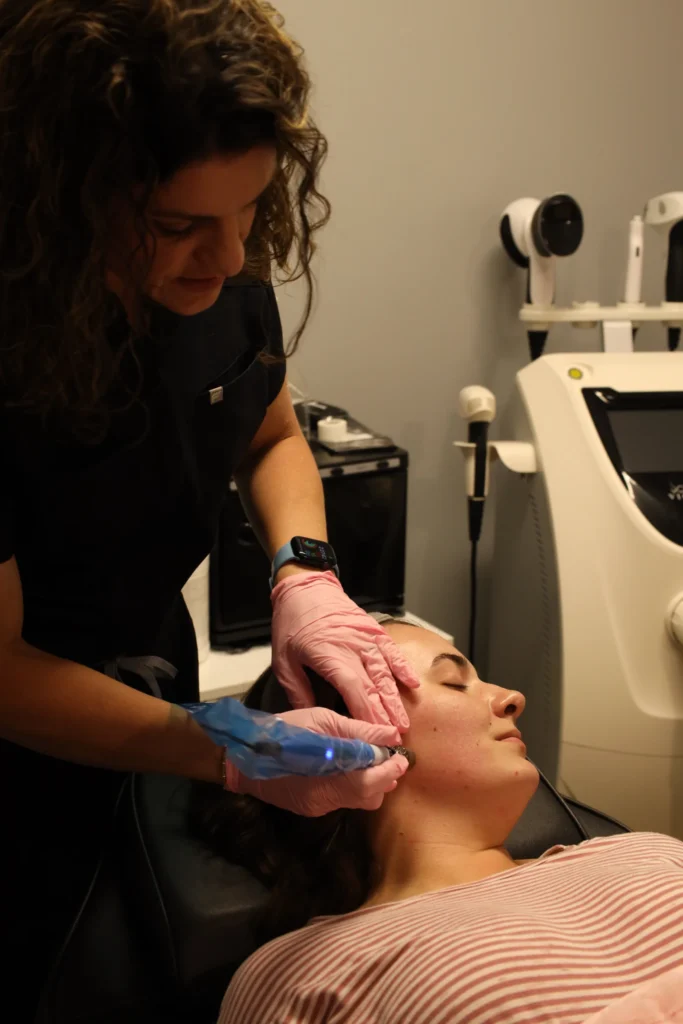 skin needling
