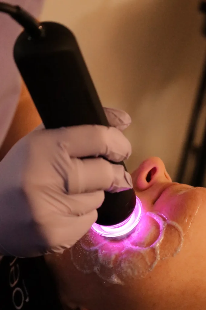 non-surgical facelift