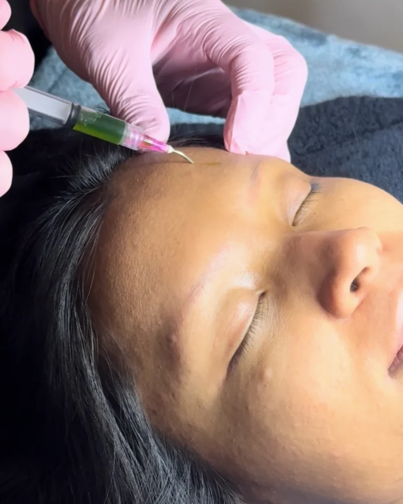 skin rejuvenation