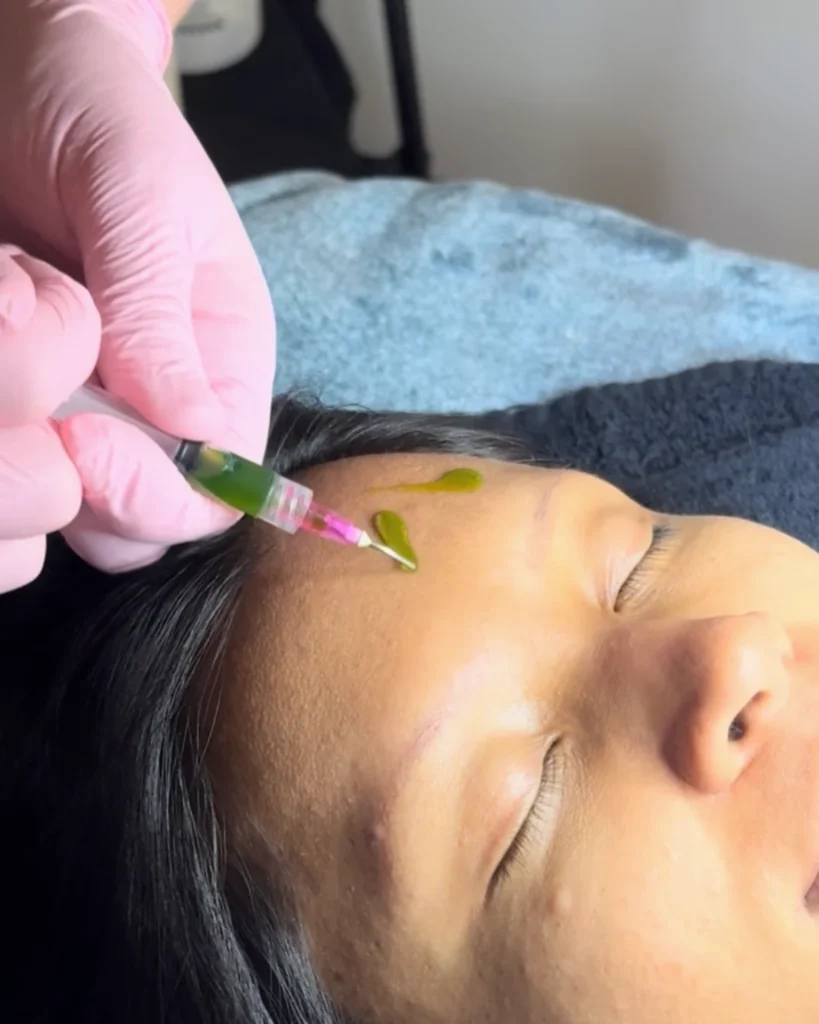 exfoliating facial