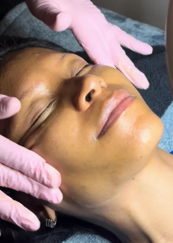 skin rejuvenation