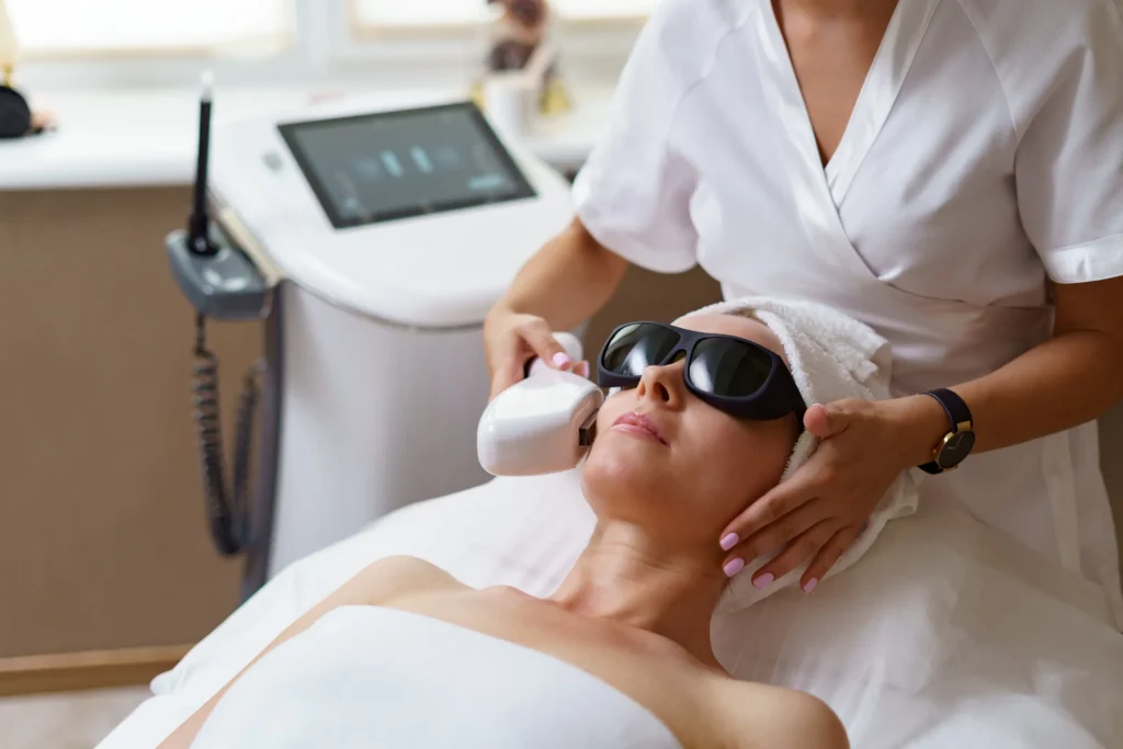 IPL treatment